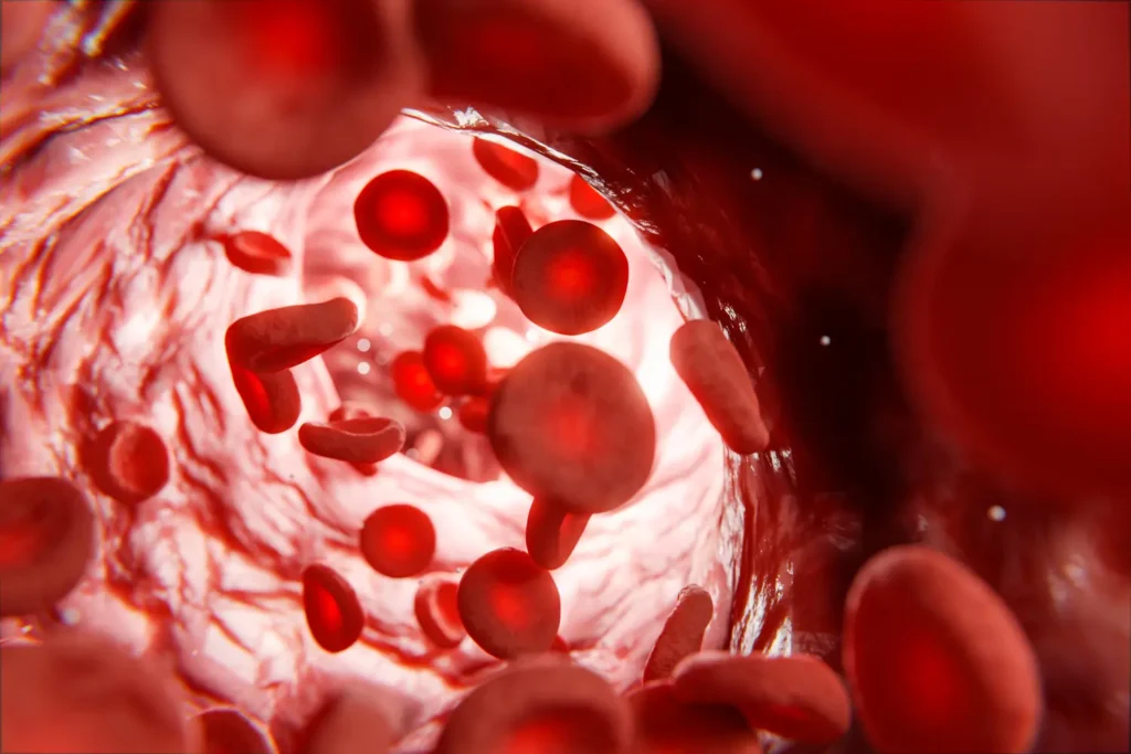 Ilustración de glóbulo rojo normal vs glóbulo deformado Anemia drepanocítica en detalle