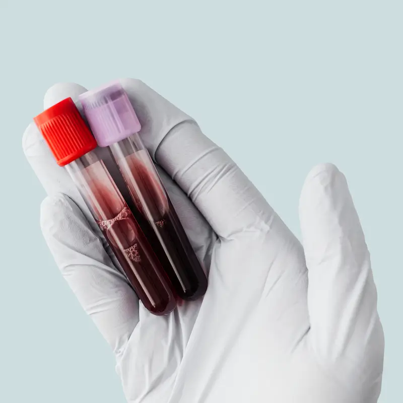 Profesional de salud explicando el tipo de anemia a una paciente