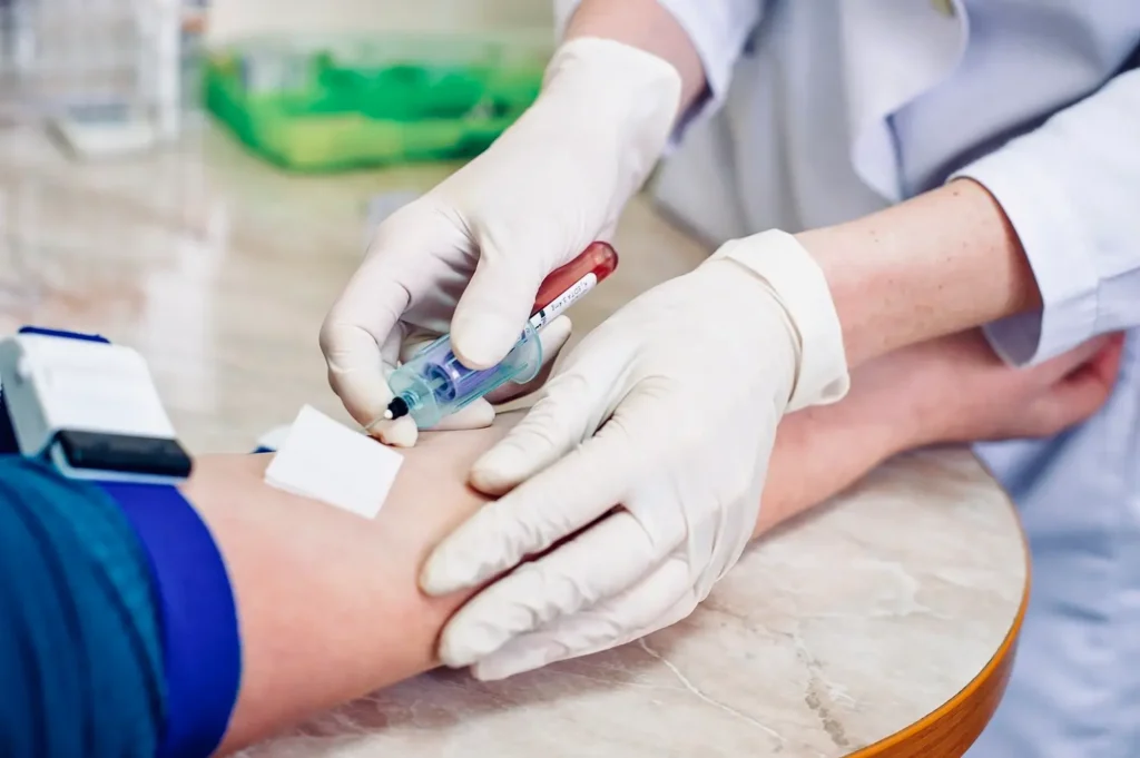 policitemia vera sangre espesa