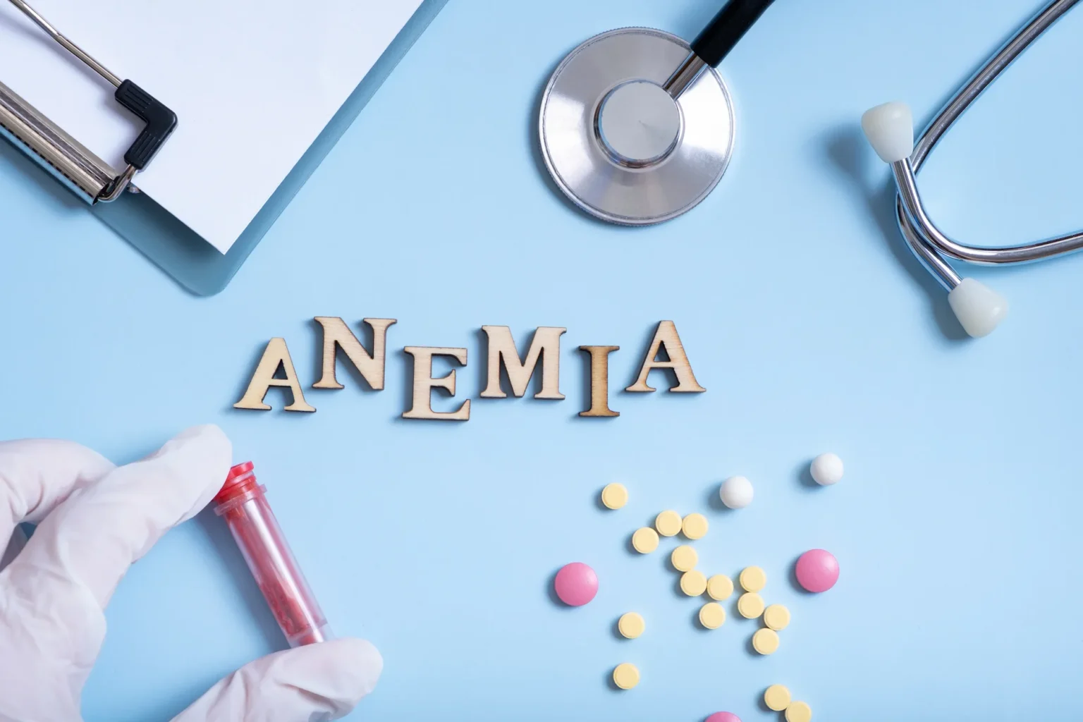 anemia aplásica - clinica de anemia